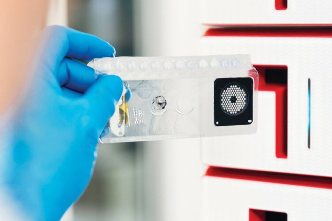 ANS inclui teste para meningite e encefalite no rol