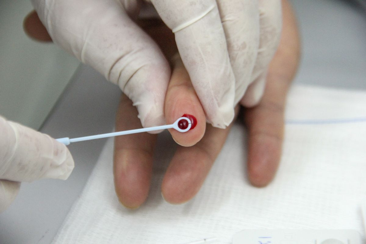 teste doenças sexuais barueri