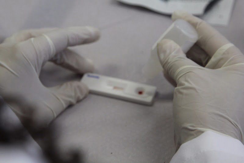teste hiv sífilis ubs